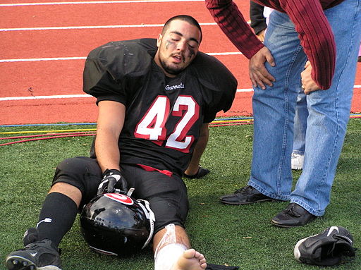 Due to the constant head trauma that football players experience, they are at risk for developing CTE in the future. Anthony22 at English Wikipedia, CC BY-SA 3.0 , via Wikimedia Commons